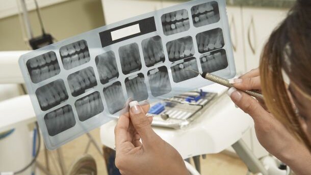 VGZ haalt maximum van vergoeding code X10