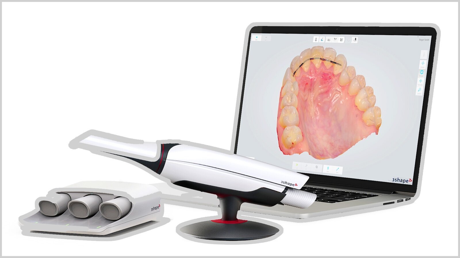 Tecnologías y características de los escáneres intraorales (2)