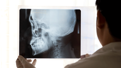 Bei Rheuma immer auch zum MKG-Chirurgen Bei Rheuma immer auch zum MKG-Chirurgen