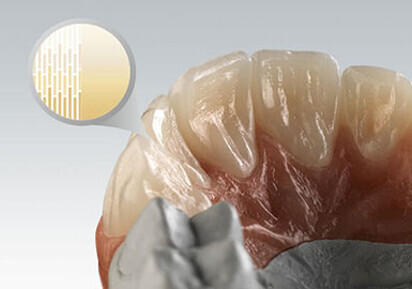 Amann Girrbach - Zolid FX Multilayer