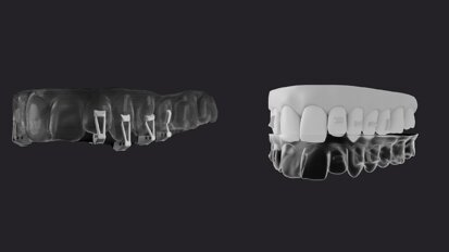 The power of precision—Clarity Precision Grip Attachments