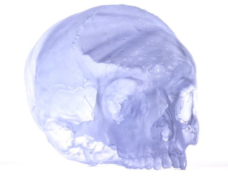 Fig. 7. Cráneo transparente impreso en 3D, con finos detalles y una forma que se asemeja a los que se ven en los museos.