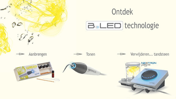 B.LED-technologie: een doorbraak in het verwijderen van plaque
