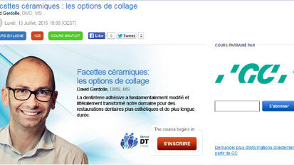 Webinaire « Facettes céramiques : les options de collage »