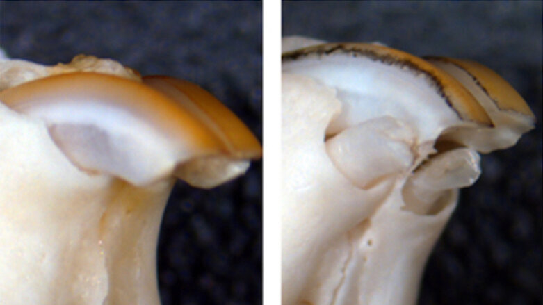 Kaybedilen Dişler Yeniden Çıkabilir mi?