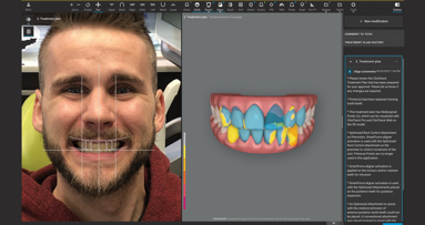 “Patients prefer dentists who take a minimally invasive approach”