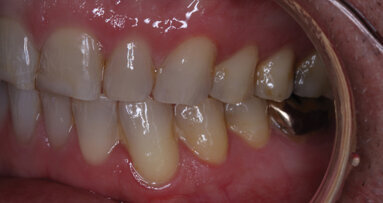 3-D Vision: Let the journey begin with a passport to the future