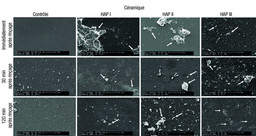 Fig. 7 : Micrographies MEB de la pellicule sous un grossissement de 5 000 fois et les nano-HAP sur les échantillons de céramique. La formation de la pellicule et les particules d’hydroxyapatite sont visibles à trois moments d’evaluation différents : immédiatement après l’utilisation de la solution de rinçage a base de HAP I, HAP II et HAP III a 5 %, puis 30 minutes et deux heures après. Les flèches blanches indiquent les HAP accumulées sur la surface de céramique. Les HAP III tendent à s’accumuler sur les irrégularités de surface après deux heures (astérisques blancs).