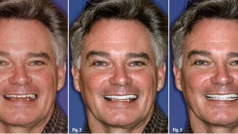 Un nouveau sourire, nouvelle vie : les technologies et techniques novatrices peuvent transformer un sourire