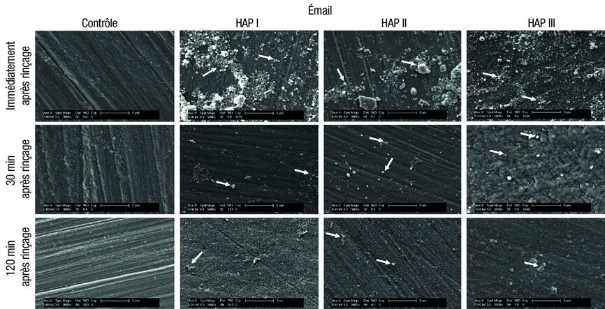 Fig. 5  : Micrographies MEB de la pellicule sous un grossissement de 5 000 fois et les nano-HAP sur les échantillons d’email. La formation de la pellicule et les particules d’hydroxyapatite sont visibles à trois moments d’évaluation différents : immédiatement après l’utilisation de la solution de rinçage à base de HAP I, HAP II et HAP III a 5 %, puis 30 minutes et deux heures après. Les flèches blanches indiquent les HAP accumulées sur la surface de l’email.