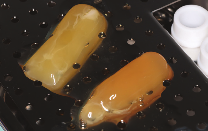 Figure 5: After collection the PRF itself placed on tray ready to be converted into membrane.