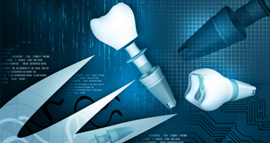 Kaum Unterschiede zwischen Titan- und Zirkonimplantaten