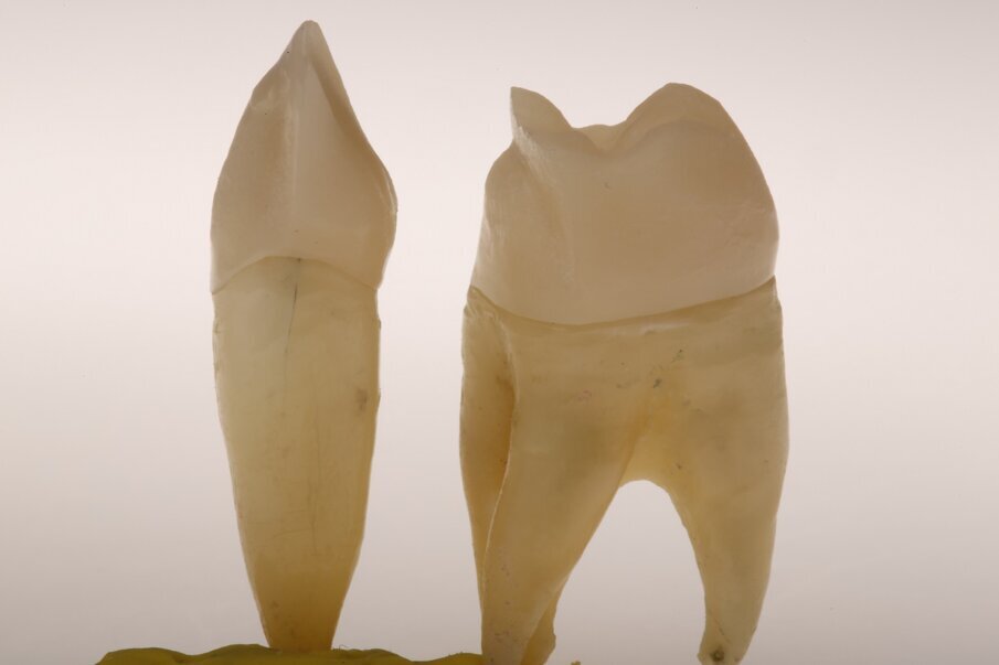 Fig. 12c: Light dynamics of natural teeth in direct and indirect light.