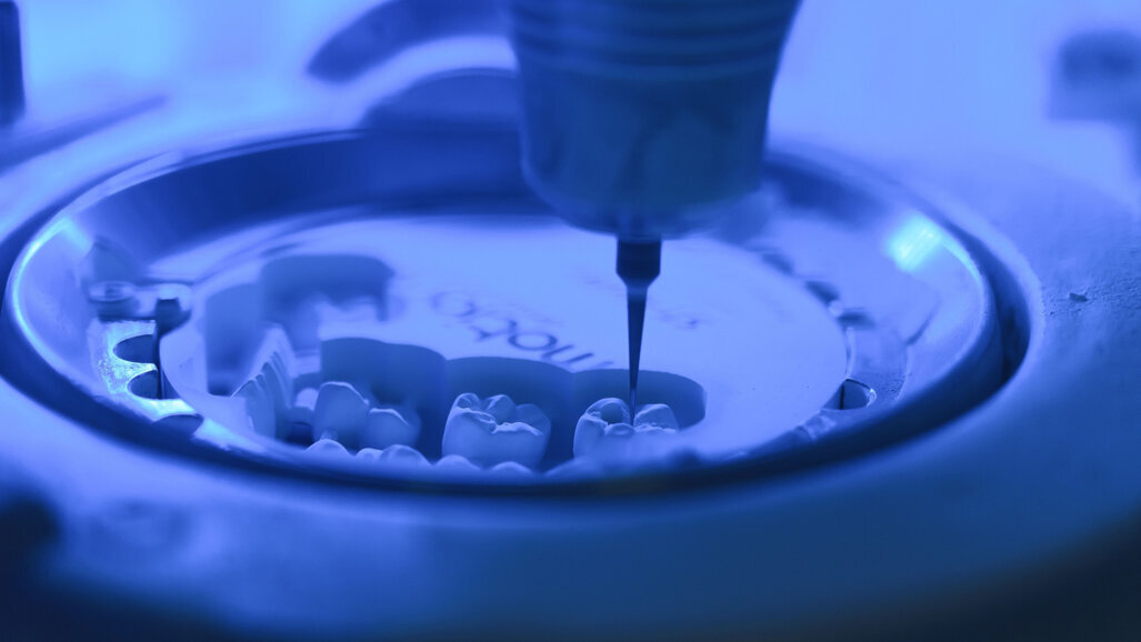 Wanted: Research on 3D-printed zirconia restorations