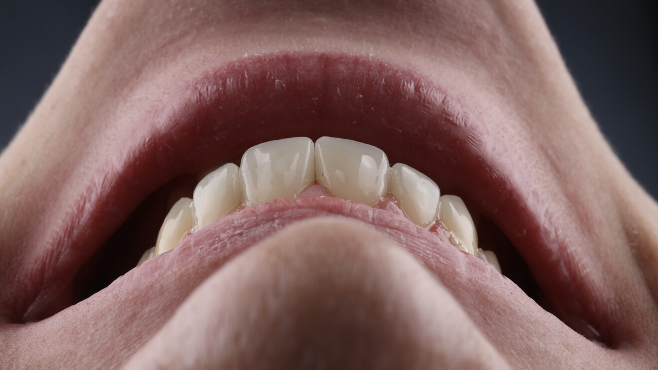 Fig. 7c: Incisal view.