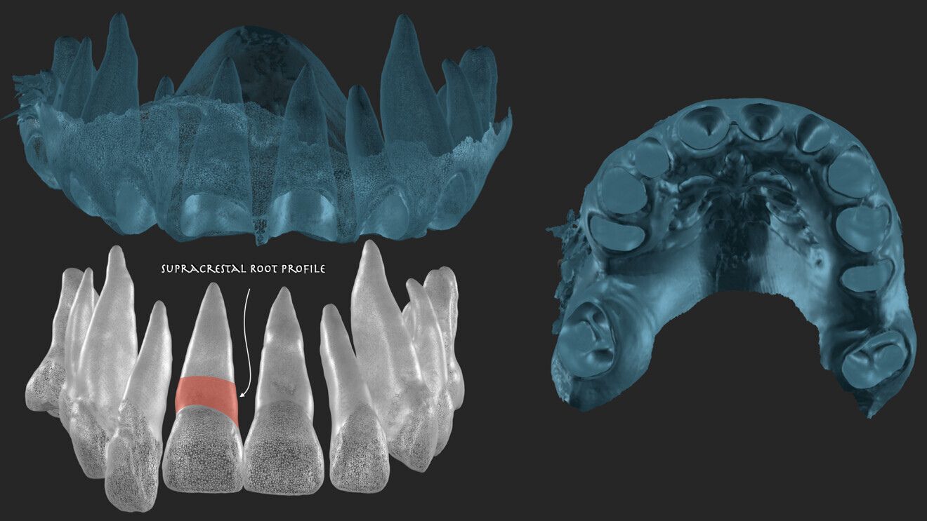 Fig. 7: Combined extraction model.