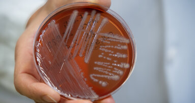 Freiburg researchers explore unknown oral bacteria in periodontitis research