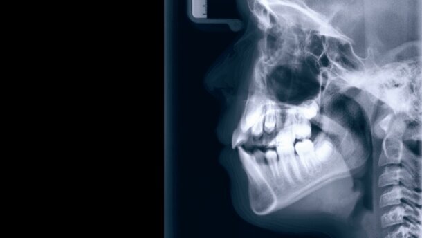 Die Bedeutung des Kiefergelenkes