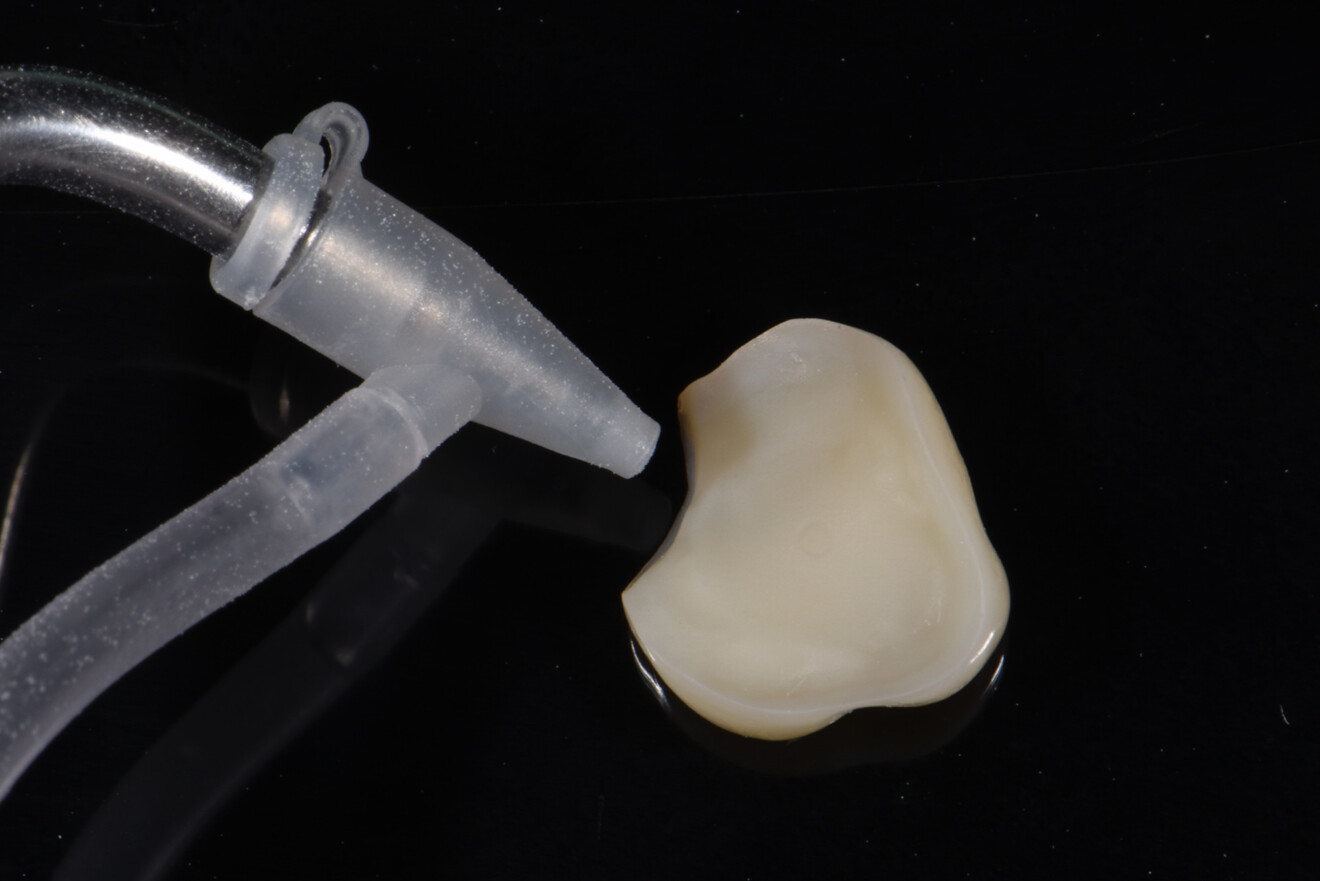 Fig. 24: Air abrasion of the intaglio surface of the restoration.