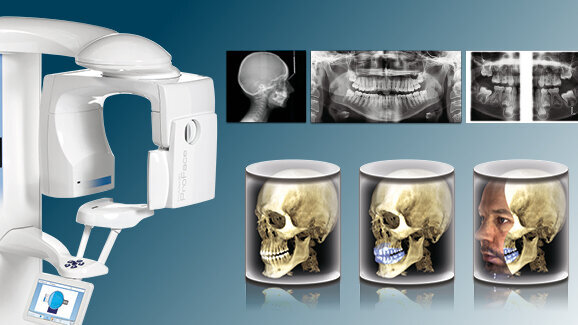 Questions les plus fréquentes concernant Planmeca ProMax 3D – Unit tout en un répondant à tous les besoins de l’imagerie