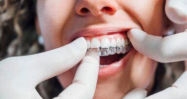 Ensuring predictable results in clear aligner therapy