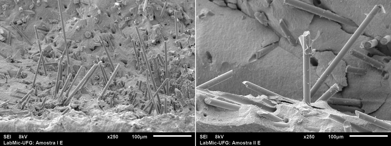 Short E-glass fibres with an optimised aspect ratio in a fibre-reinforced composite, providing crack-bridging reinforcement that supports the biomimetic approach to dentine replacement.
