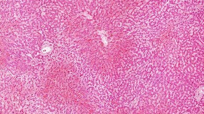 Gas koji uzrokuje neprijatan zadah omogućuje uzgoj matičnih ćelija dobijenih iz zuba