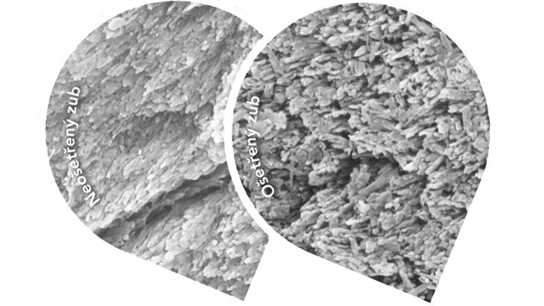 Remineralizace: preventivní a terapeutický přístup v managementu tvrdých zubních tkání