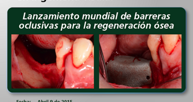 Lanzamiento mundial en Colombia de Nuevas Barreras Oclusivas