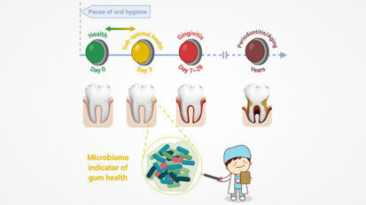 Study identifies asymptomatic state of gingivae that links gingivitis, periodontitis and ageing Study identifies asymptomatic state of gingivae that links gingivitis, periodontitis and ageing