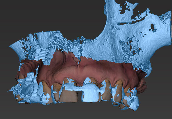 Fig. 7 - Sovrapposizione del File PLY della ceratura e dei tessuti.