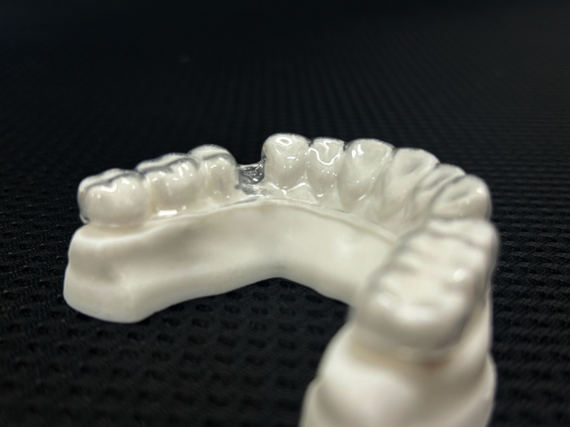 Fig. 13c: Edentulous area without block out shows poor adaptation of the thermoformed PETG aligner.
