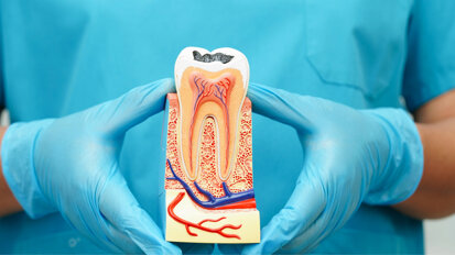 Therapeutic pulpotomy emerging as an alternative to root canal therapy