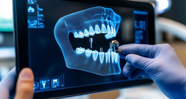Νέα μελέτη ρίχνει φως στις απόψεις των ασθενών για τη διάγνωση με τεχνητή νοημοσύνη στην οδοντιατρική