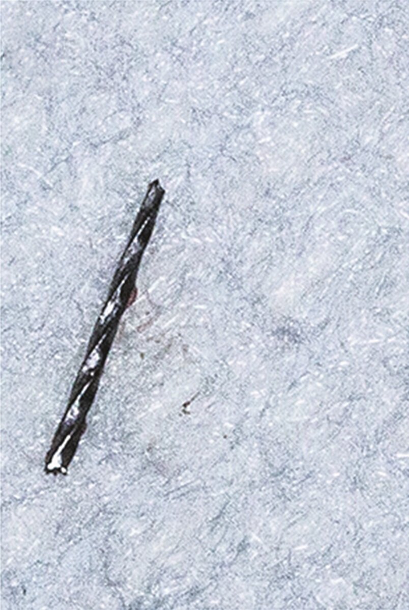 Fig. 2j: Removed separated instrument.