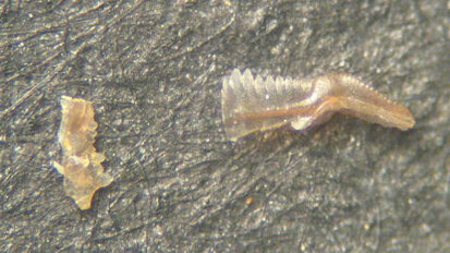 Pesquisa em fósseis pode revelar a origem dos dentes