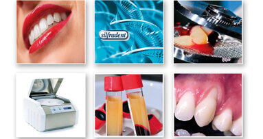 Concentrato di fattori di crescita  (Concentrated Growth Factors – CGF): un importante strumento nella medicina rigenerativa