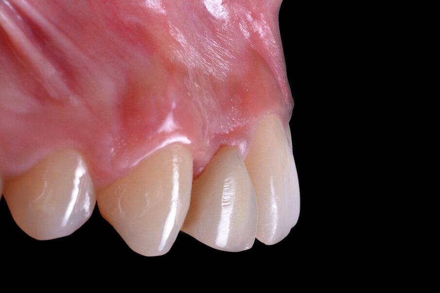 Fig. 3 - Situazione clinica iniziale (visione laterale).