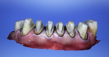 Wielofunkcyjne wykorzystanie systemu CAD/CAM w kompleksowej rehabilitacji zwarcia