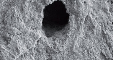 Klinické použití Er,Cr:YSGG laseru při endodontickém ošetření