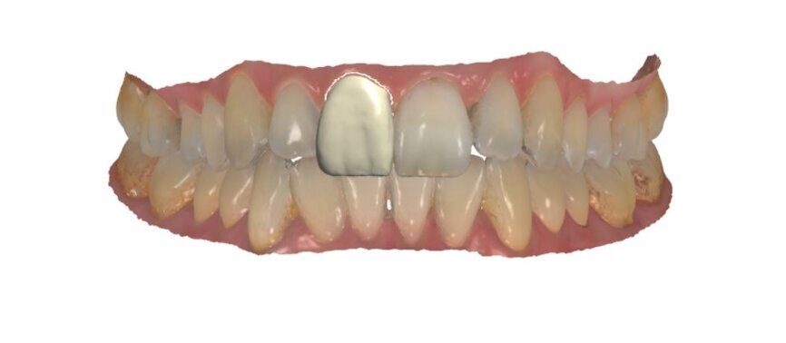 11 Trios couleur vestibulaire