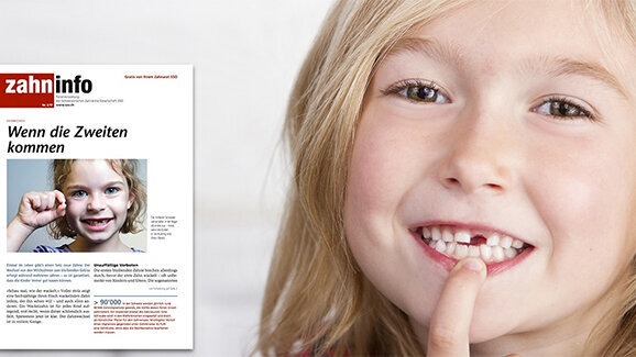 Zahninfo widmet sich dem Thema Wechselgebiss