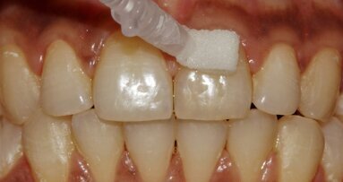 Curodont Repair Fluoride Plus: “Our experience has been extremely positive”