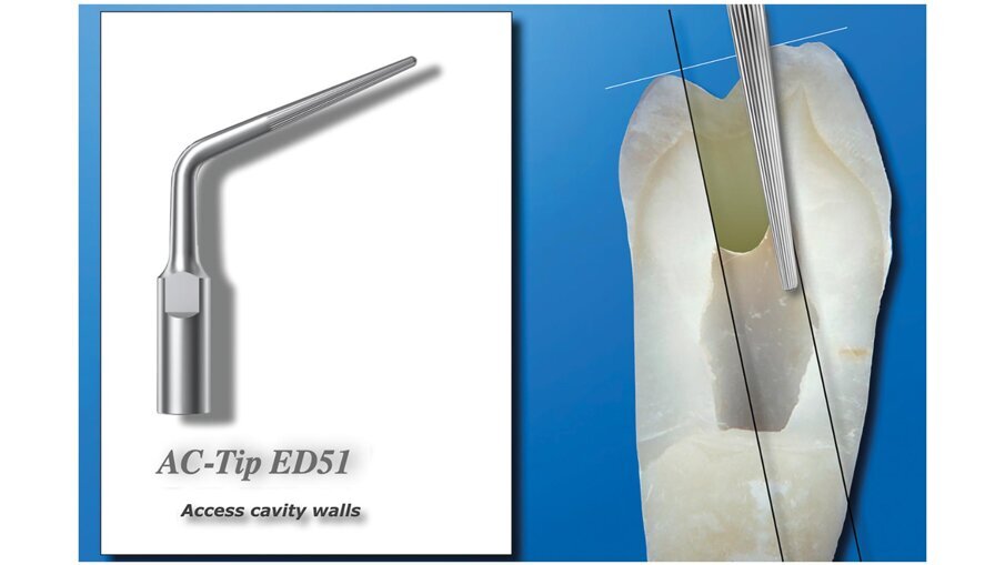 Fig. 6 - La A-C Tip ED51 è disegnata per la rifinitura delle pareti della cavità d’accesso dei premolari superiori e inferiori.