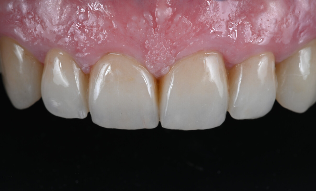 Fig. 11 : Résultat du traitement.