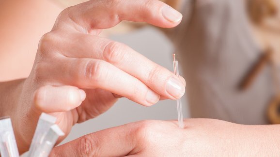 Akupunktura: Hledá cestu do stomatologie – Část I