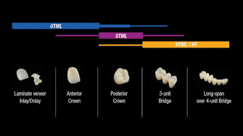 Zirconia multistrato in diversi livelli di traslucenza