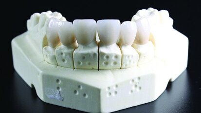 Зъботехниката: моето призвание