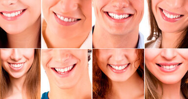 Meglio un sorriso perfetto o “globalizzzato” oppure con qualche difetto ma personale?