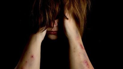 Opfer häuslicher Gewalt erhalten neues Lächeln Opfer häuslicher Gewalt erhalten neues Lächeln